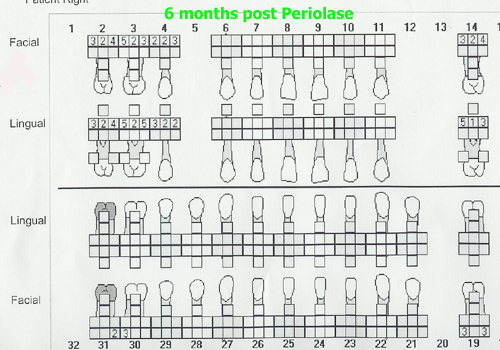 6mthpostperiolase.jpg